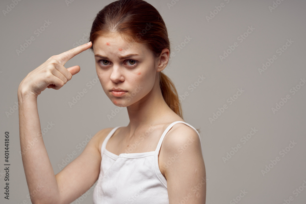 beautiful woman gesturing with her hands near face acne skin problems acne
