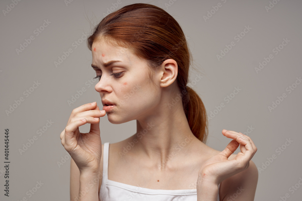 beautiful woman gesturing with her hands near face acne skin problems acne beautiful woman gesturing with her hands near face acne skin problems acne