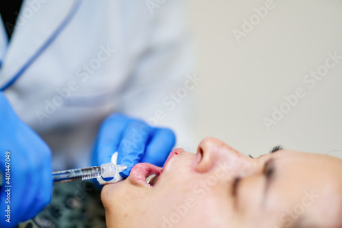 Lip Augmentation. Woman Getting Beauty Injection For Lips.The doctor cosmetologist makes Lip augmentation procedure of a beautiful woman in a beauty salon.