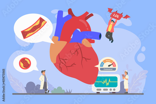 High Cholesterol blood pressure and Low Density Lipoprotein tiny person illustration concept