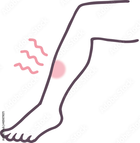 赤く腫れた足のイラスト素材