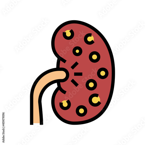 nephritis kidney color icon vector. nephritis kidney sign. isolated symbol illustration