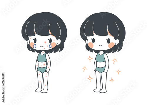 アトピー・蕁麻疹・湿疹に苦しむ人と治った人のビフォーアフター・ベクター