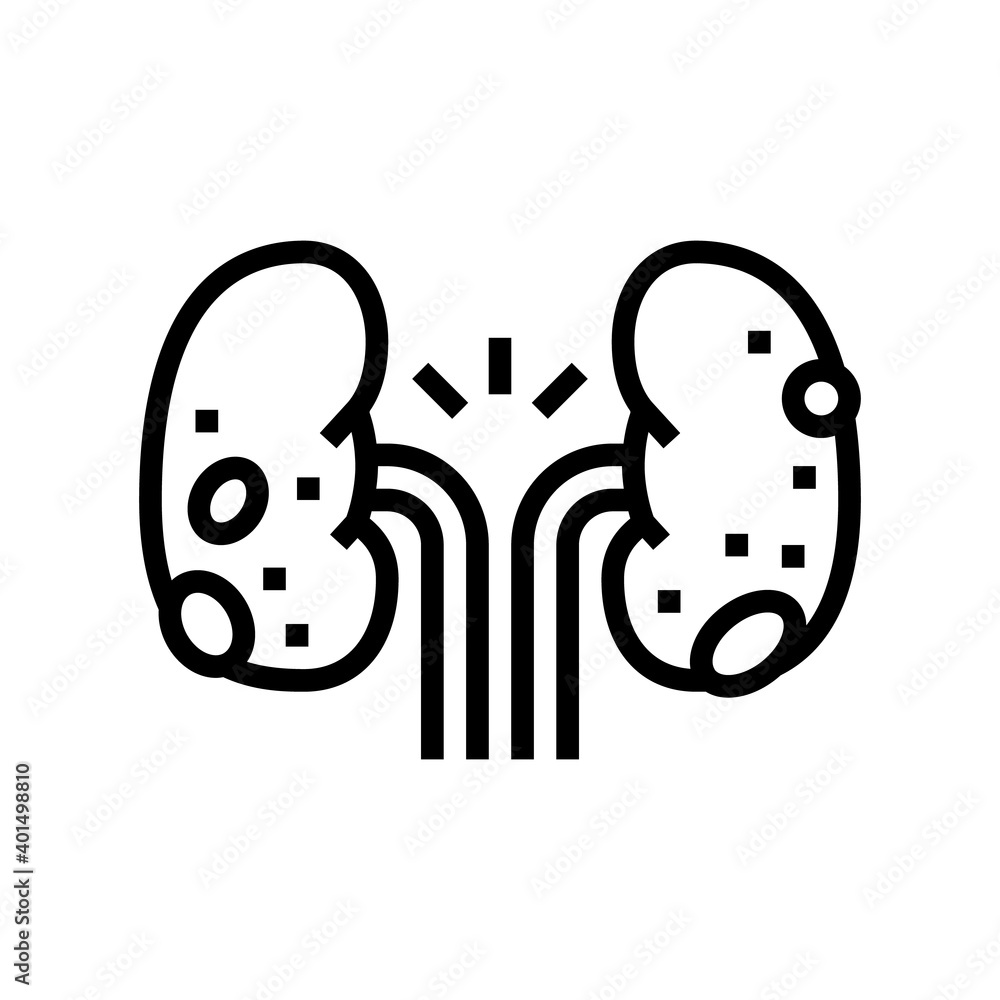 glomerulonephritis kidney disease line icon vector. glomerulonephritis kidney disease sign. isolated contour symbol black illustration