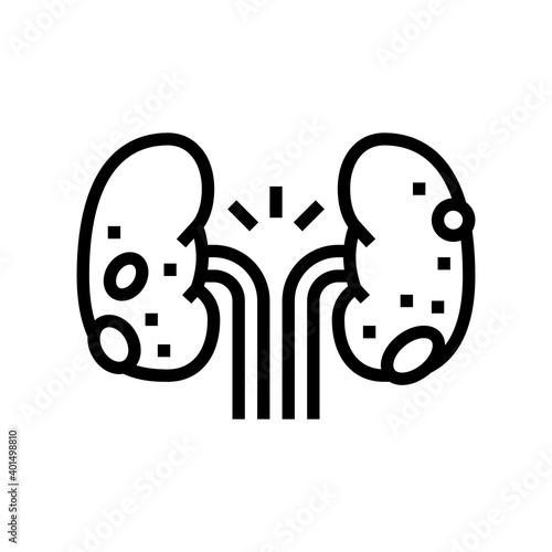 glomerulonephritis kidney disease line icon vector. glomerulonephritis kidney disease sign. isolated contour symbol black illustration