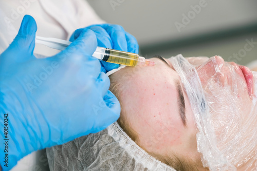 PRP therapy in beauty clinic. Cosmetologist doing injections of blood plasma to womans forehead to cure problem skin  closeup side view. Treatment of skin in cosmetology for young female.