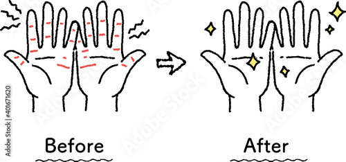 あかぎれがスキンケアで綺麗になった手のイラスト　ビフォーアフター Illustration of a hand with chapped skin that has been cleaned up with skin care before and after
