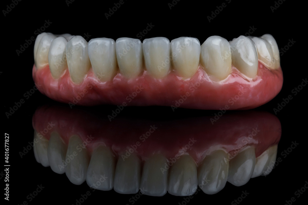 lower jaw prosthesis on black glass with reflection lower jaw prosthesis on black glass with reflection