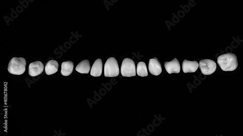 set of high esthetics ceramic veneers for the upper jaw, shot from above on a black background in black and white style