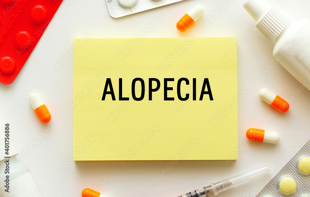 Notepad with text ALOPECIA on a white background. Medical concept. Notepad with text ALOPECIA on a white background. Medical concept.
