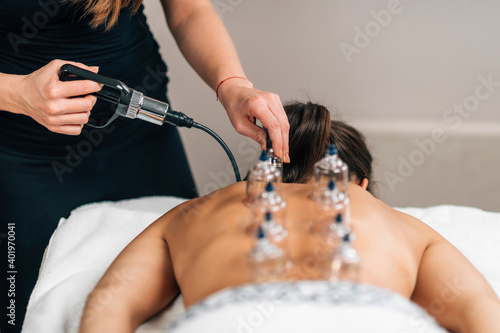 Cupping Therapy on Women's Back photo