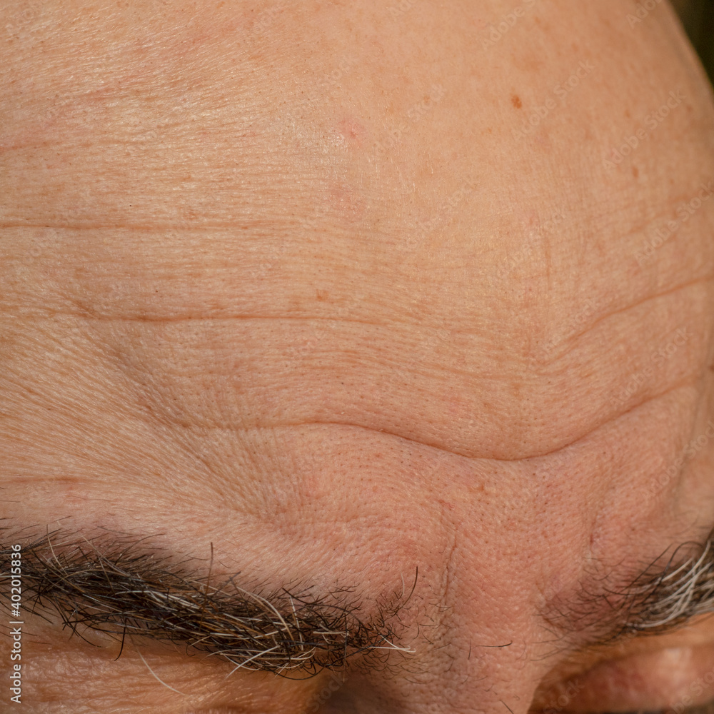 Pronounced wrinkles on the forehead of man. Pronounced wrinkles on the forehead of man.