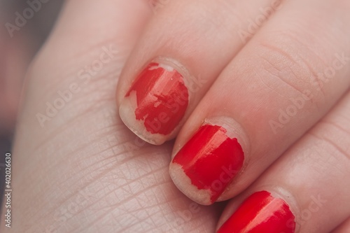 Chipped red nails. Dry nails . Damaged fingernails.
