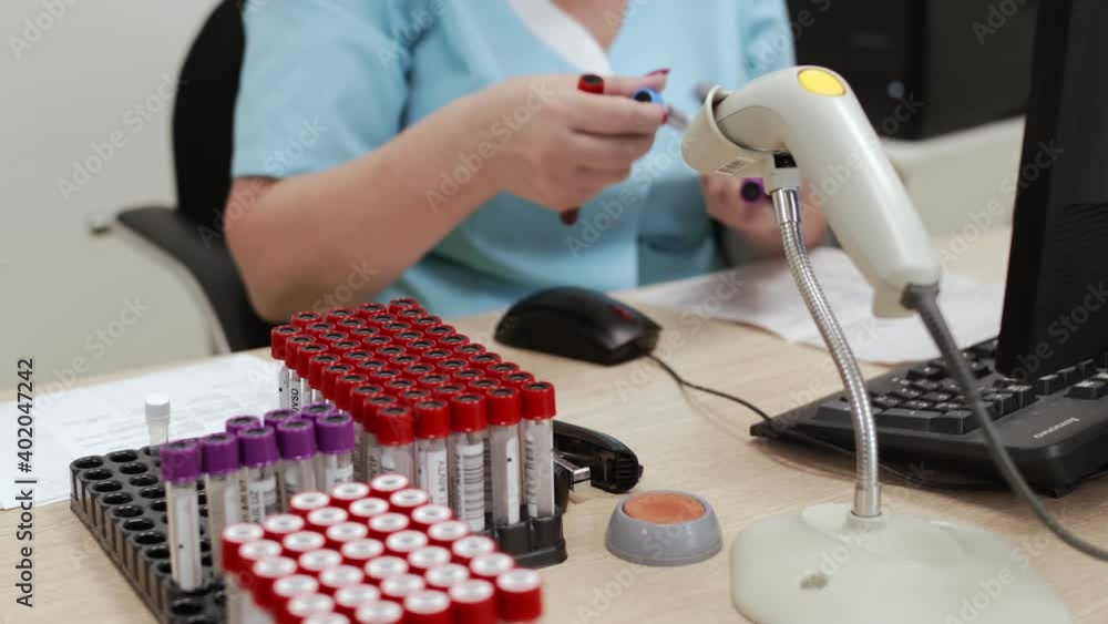 Lab technician prepares urine samples to urinalysis in automated ...