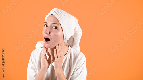  Close-up portrait of young surprised woman with opened mouth. Woman with problem skin. Daily skincare routine photo