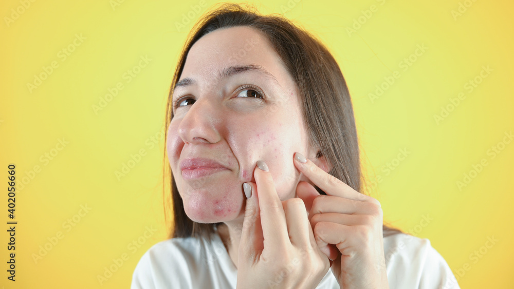 Portrait of sad brunette woman touching her face and looking for acne. Acne spot pimple spot skincare beauty care girl pressing on skin problem face. Portrait of sad brunette woman touching her face and looking for acne. Acne spot pimple spot skincare beauty care girl pressing on skin problem face.