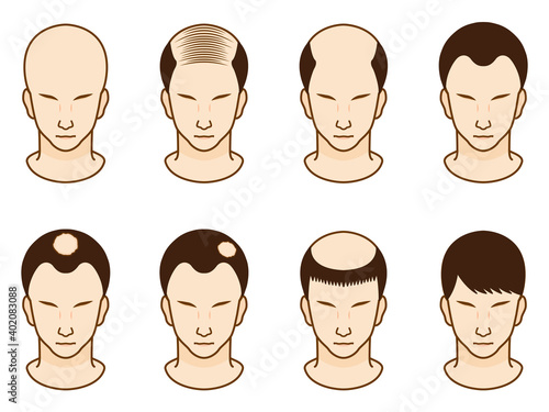 ハゲ頭の男性のアイコンイラストセット2