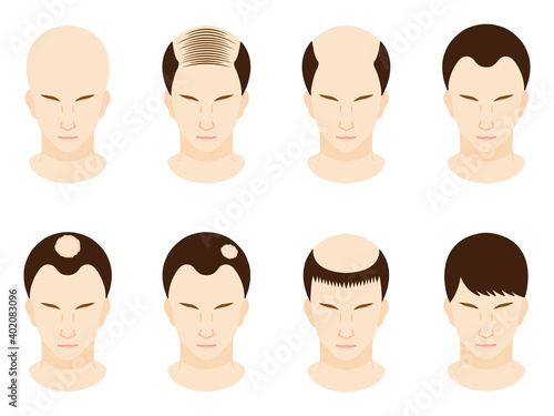 ハゲ頭の男性のアイコンイラストセット4