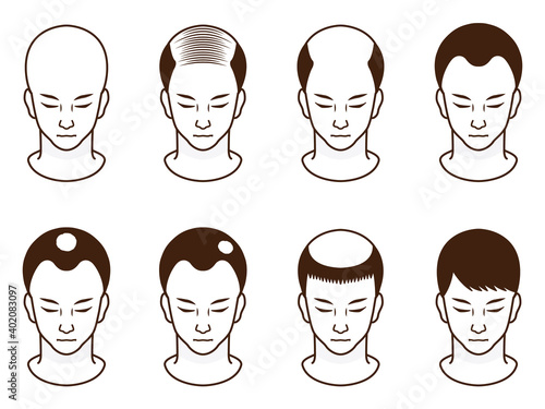 ハゲ頭の男性のアイコンイラストセット5