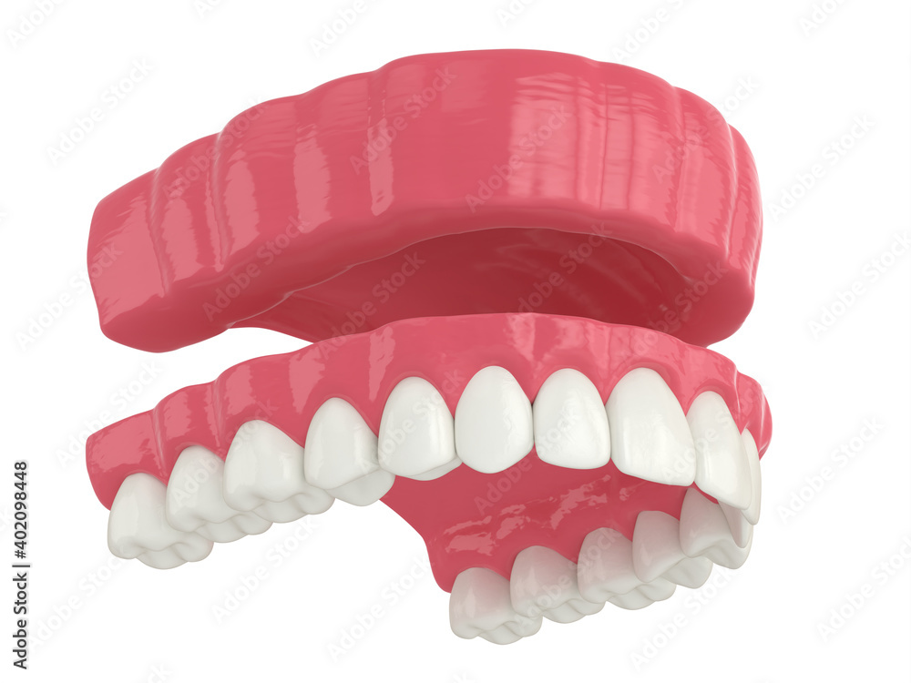 Fototapeta premium 3d render of removable traditional denture installation