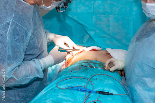 plastic surgeon sutures the incision to the patient after breast surgery.