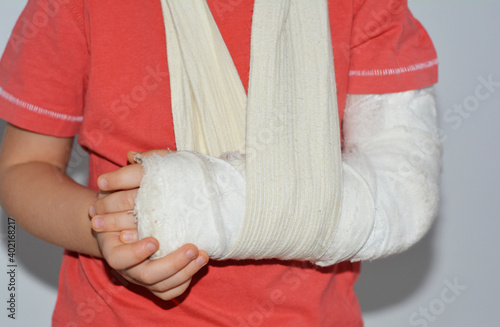 A close-up of a child, a four year old boy with a broken arm in a cast for the immobilization of a broken bone.