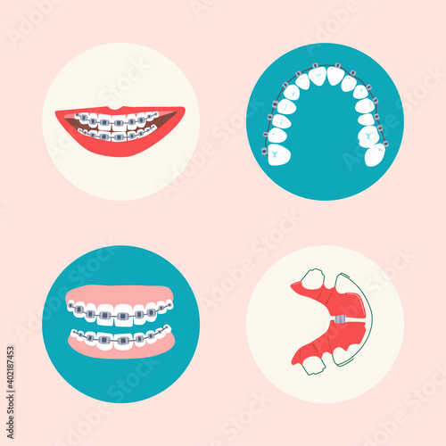 Dental braces, aligner and orthodontic metal retainers on teeth.Oral care and daily routine.Bite correction. Round icons.International day of the dentist.Vector in flat style.Cavity disease