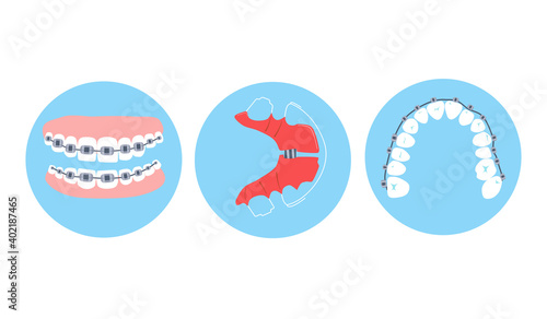 Dental braces, aligner or orthodontic metal retainers on teeth.Oral care and daily routine.Bite correction. Different projections.International day of the dentist.Vector in flat style.Cavity disease