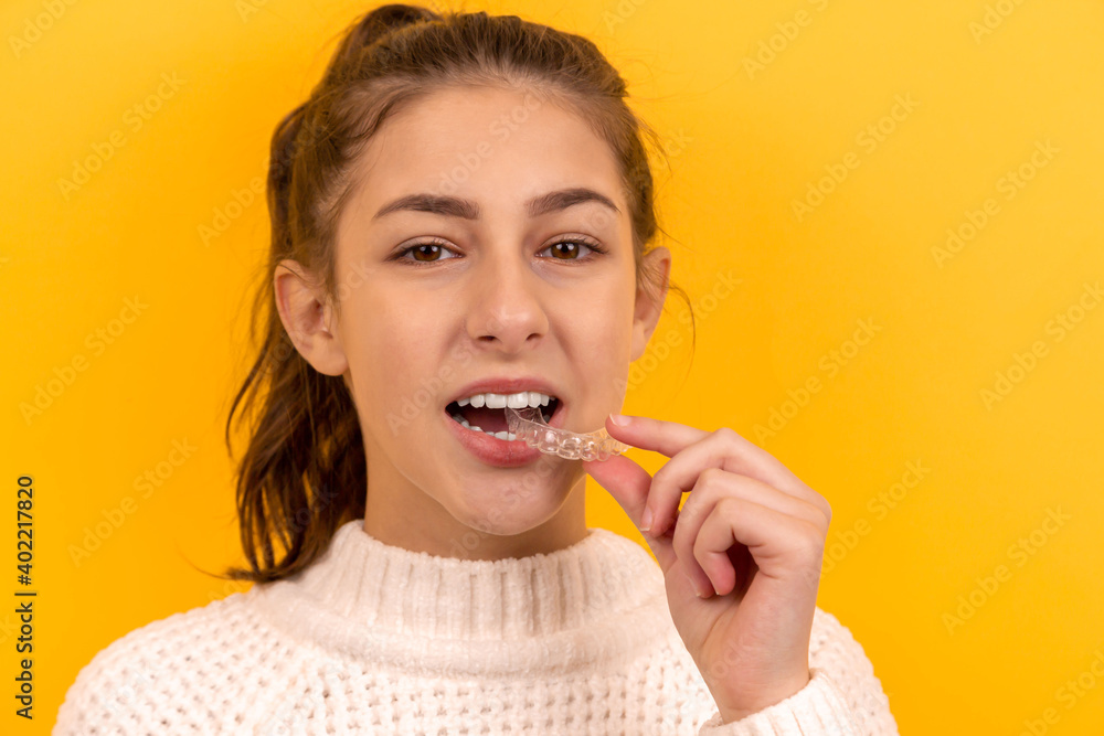 A beautiful girl puts a dental retainer on her teeth, she stands on a yellow background. Orthodontist. Dental tray. Retainer. Advertising. Place for an inscription. A beautiful girl puts a dental retainer on her teeth, she stands on a yellow background. Orthodontist. Dental tray. Retainer. Advertising. Place for an inscription.