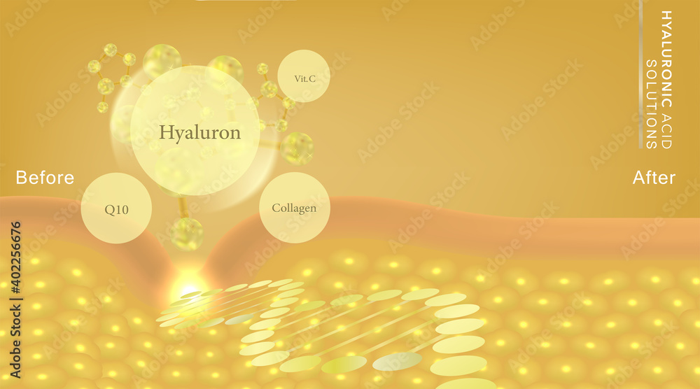 Hyaluronic acid before and after skin solutions ad, gold collagen serum drop with cosmetic advertising background ready to use, illustration vector.	