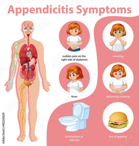 Appendicitis Symptoms information infographic