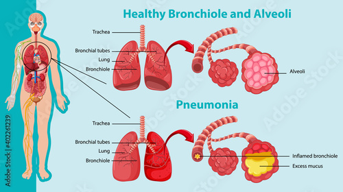 Healthy and unhealthy of human lungs