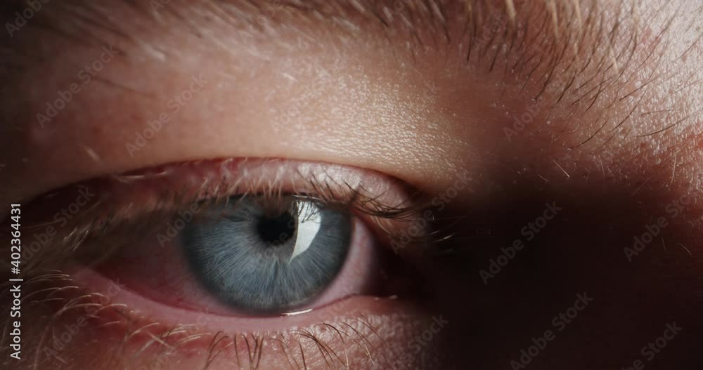 Stockvideo Red Eye with blue iris of tired guy looking around in