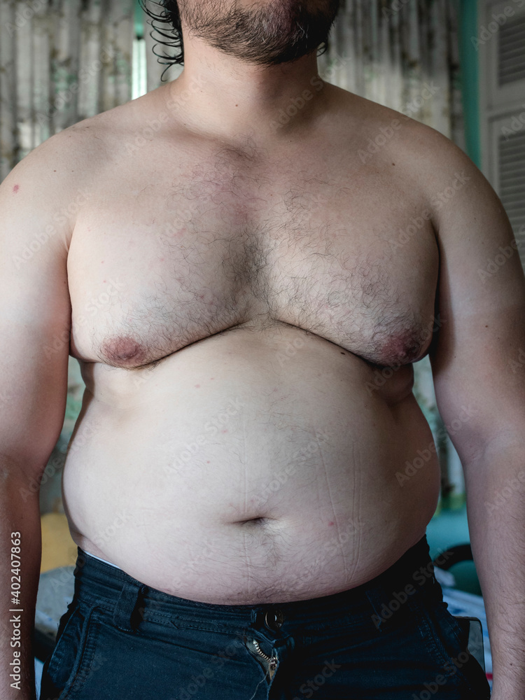 An out of shape torso, large belly, man boobs, some chest hair and