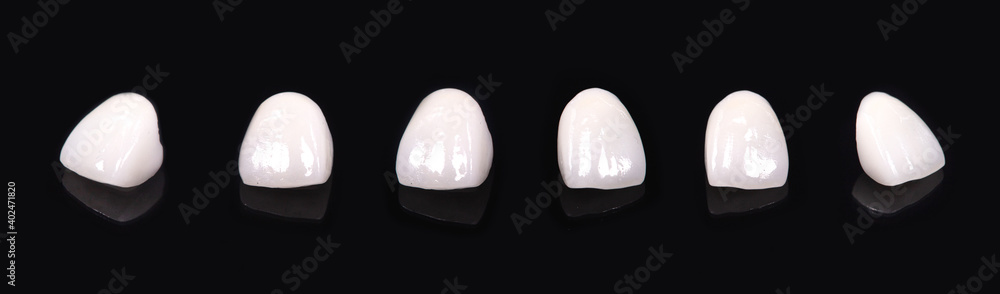 Ceramic dentures and crowns on black background. Top view on set of