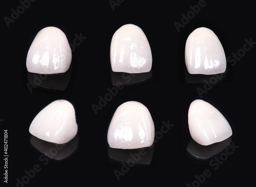 Ceramic dentures and crowns on black background. Top view on set of single dentures and dental crowns. Zirconium crown and zirconium hybrid abutment on isolated black background.  photo