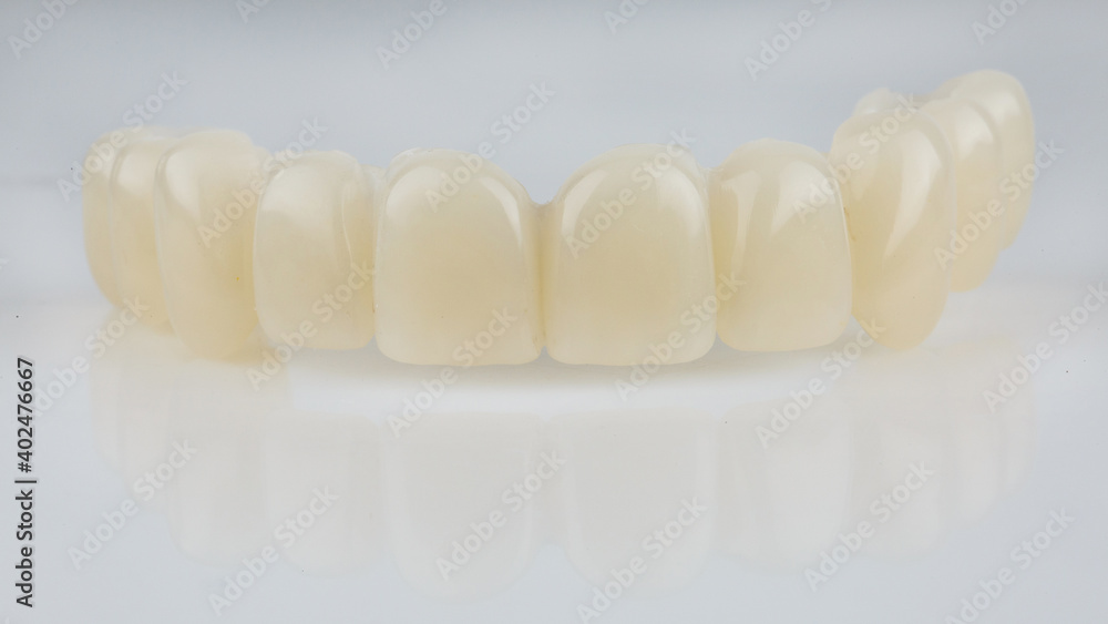 dental prosthesis for temporary upper jaw made of durable polymer on a white background dental prosthesis for temporary upper jaw made of durable polymer on a white background