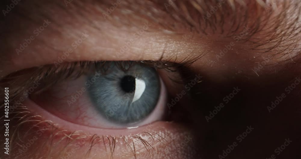 Sleep Less Red Eye Red Eye with blue iris of tired guy looking around in complete ...