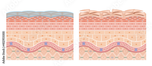 Cross section of the skin 4 front No commentary