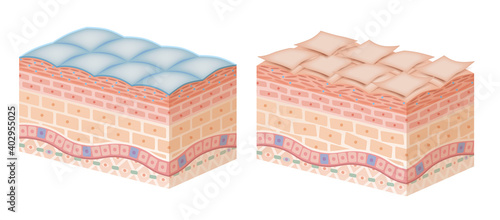 Cross section of the skin 4 No commentary