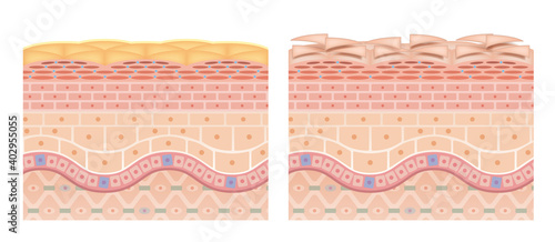 Cross section of the skin 5 front No commentary