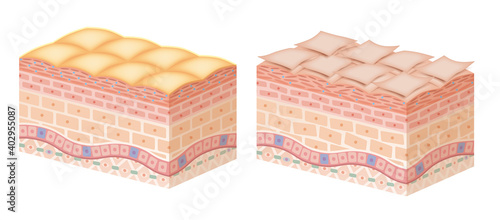Cross section of the skin 5 No commentary