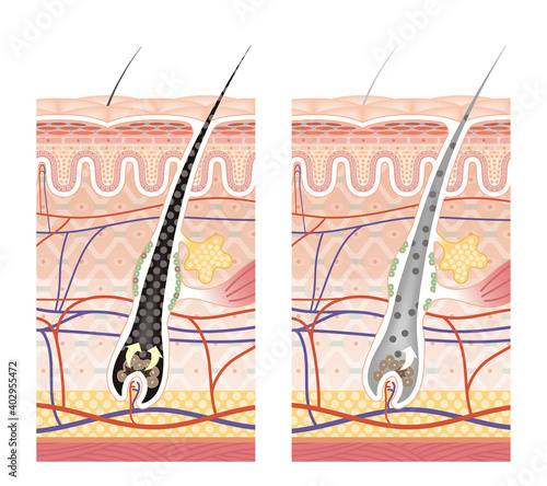 Cross section of the skin 12 front No commentary