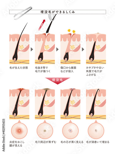 Cross section of the skin 28 front