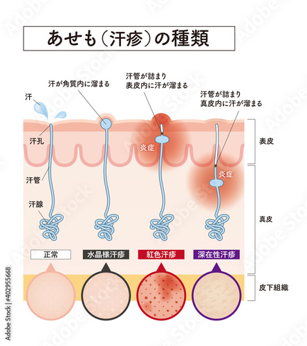 Cross section of the skin 29 front