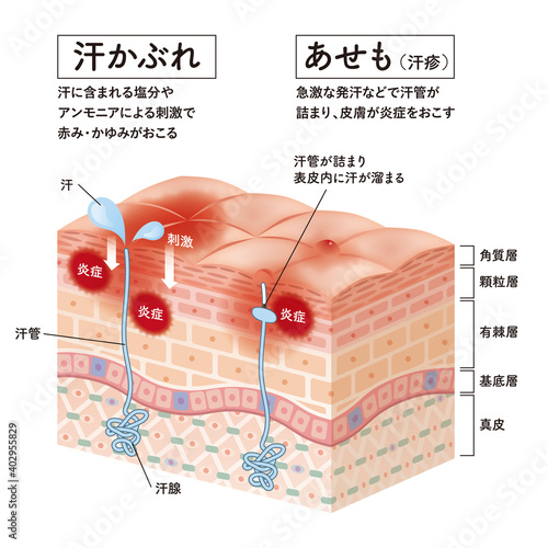 Cross section of the skin 31