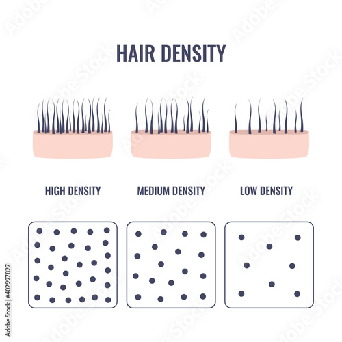 Hair density types chart of low, medium, high strand volume