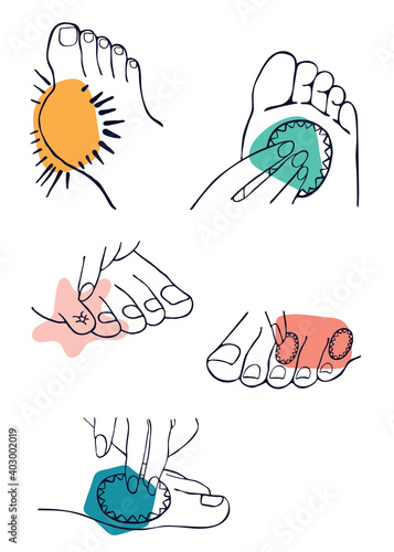 Common feet affections illustration set in graphic style,  black and white line art with colorful shapes to accentuate the problem.