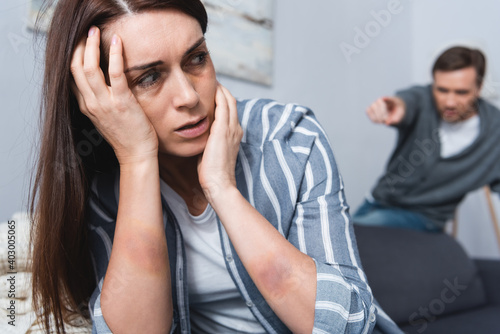  woman with bruise sitting near abusive husband pointing with finger on blurred background