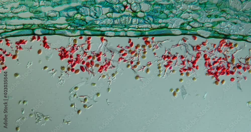 Powdery mildew on shepherd's purse tissue under the microscope 100x